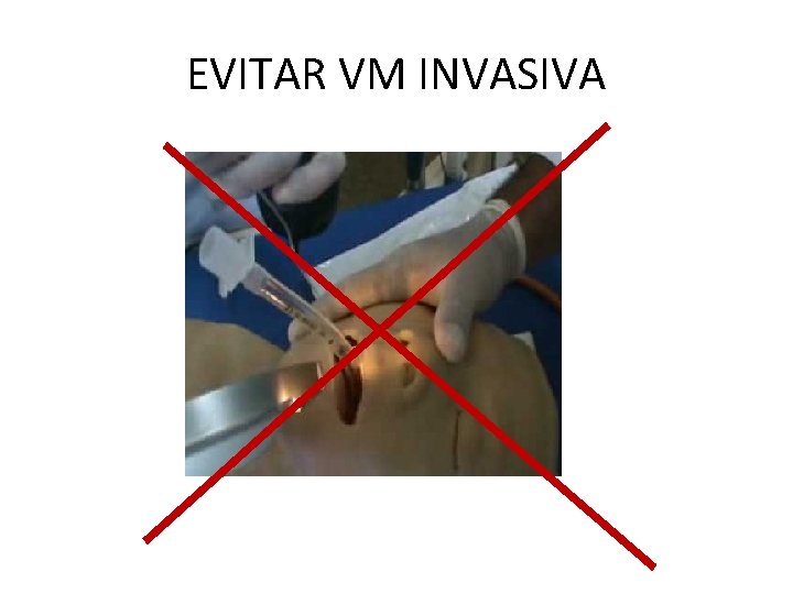EVITAR VM INVASIVA 