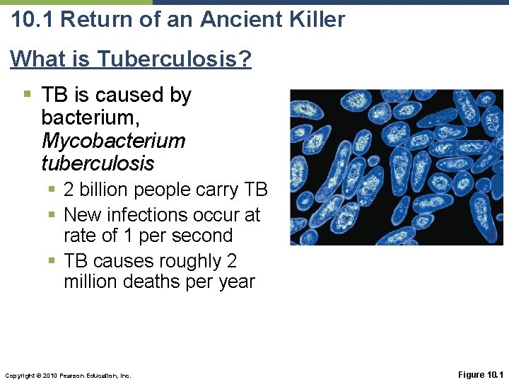 10. 1 Return of an Ancient Killer What is Tuberculosis? § TB is caused