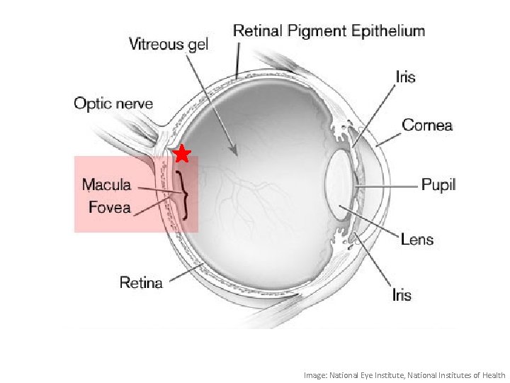 Image: National Eye Institute, National Institutes of Health 