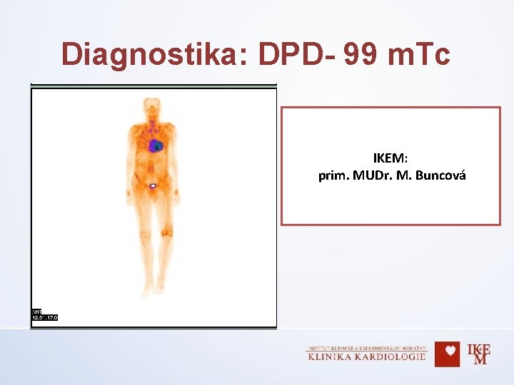 Diagnostika: DPD- 99 m. Tc IKEM: prim. MUDr. M. Buncová 