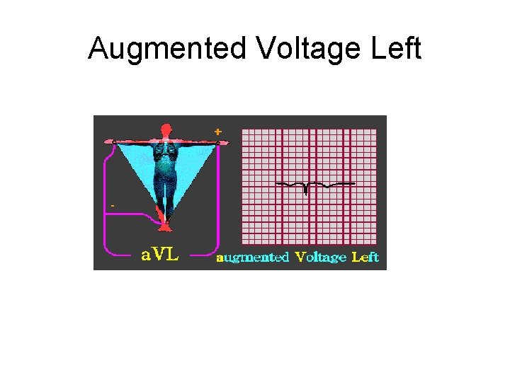 Augmented Voltage Left 