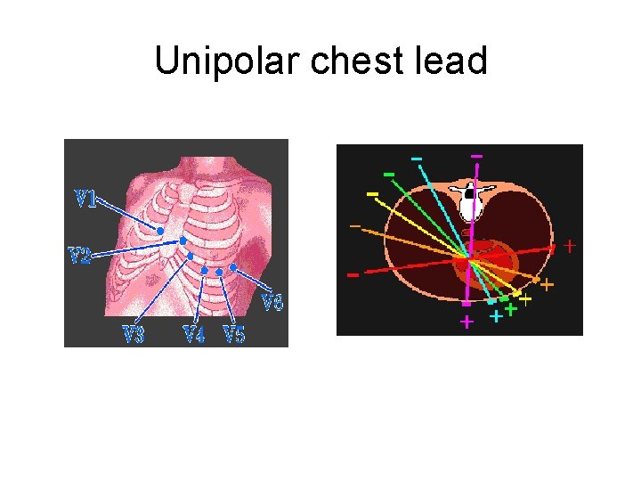 Unipolar chest lead 