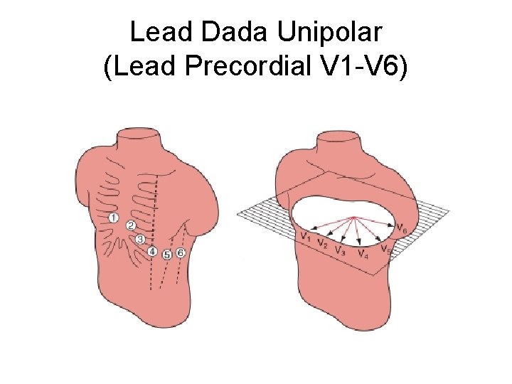 Lead Dada Unipolar (Lead Precordial V 1 -V 6) 