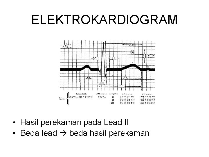 ELEKTROKARDIOGRAM • Hasil perekaman pada Lead II • Beda lead beda hasil perekaman 