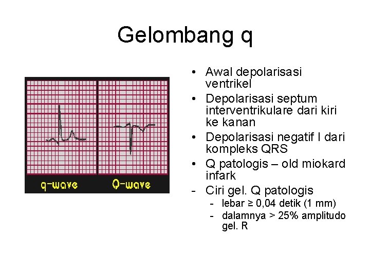 Gelombang q • Awal depolarisasi ventrikel • Depolarisasi septum interventrikulare dari kiri ke kanan