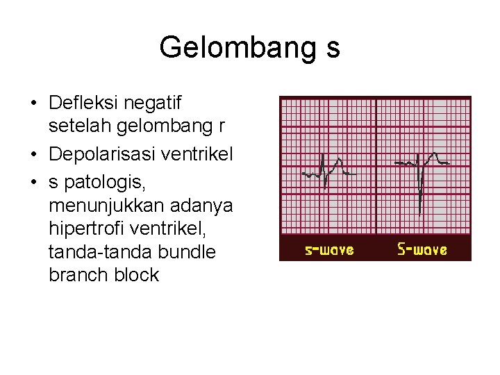 Gelombang s • Defleksi negatif setelah gelombang r • Depolarisasi ventrikel • s patologis,