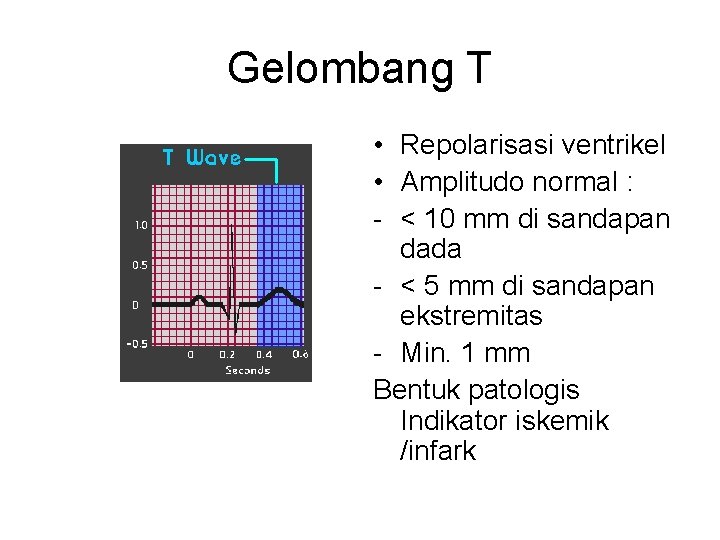 Gelombang T • Repolarisasi ventrikel • Amplitudo normal : - < 10 mm di
