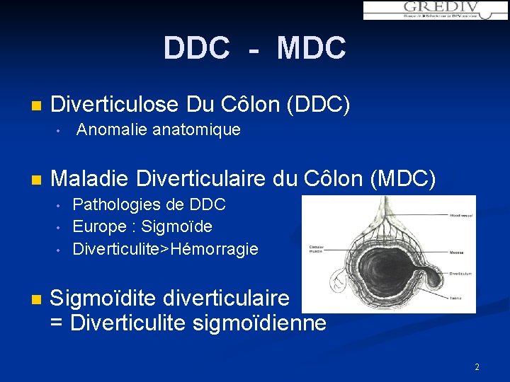 DDC - MDC n Diverticulose Du Côlon (DDC) • n Maladie Diverticulaire du Côlon