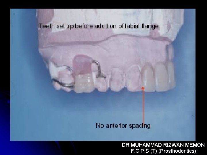 DR MUHAMMAD RIZWAN MEMON F. C. P. S (T) (Prosthodontics) 