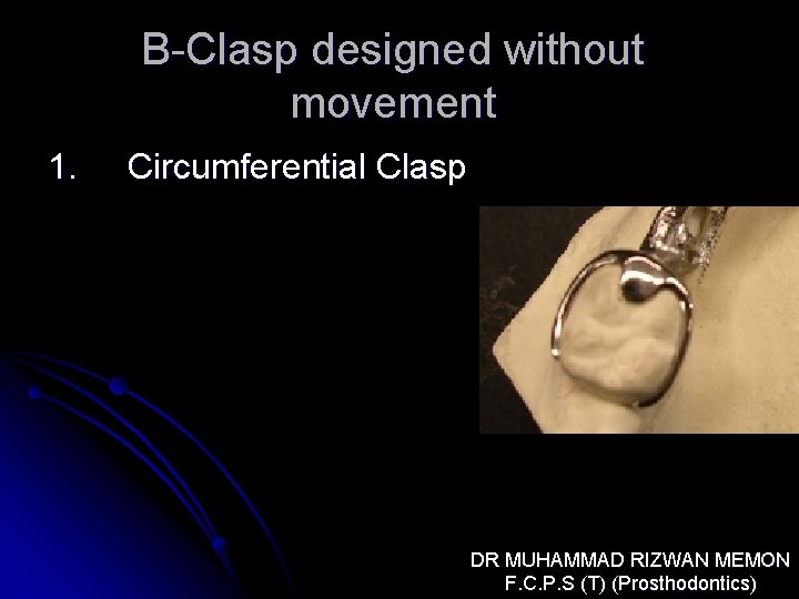 B-Clasp designed without movement 1. Circumferential Clasp DR MUHAMMAD RIZWAN MEMON F. C. P.