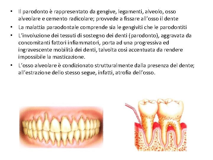  • Il parodonto è rappresentato da gengive, legamenti, alveolo, osso alveolare e cemento