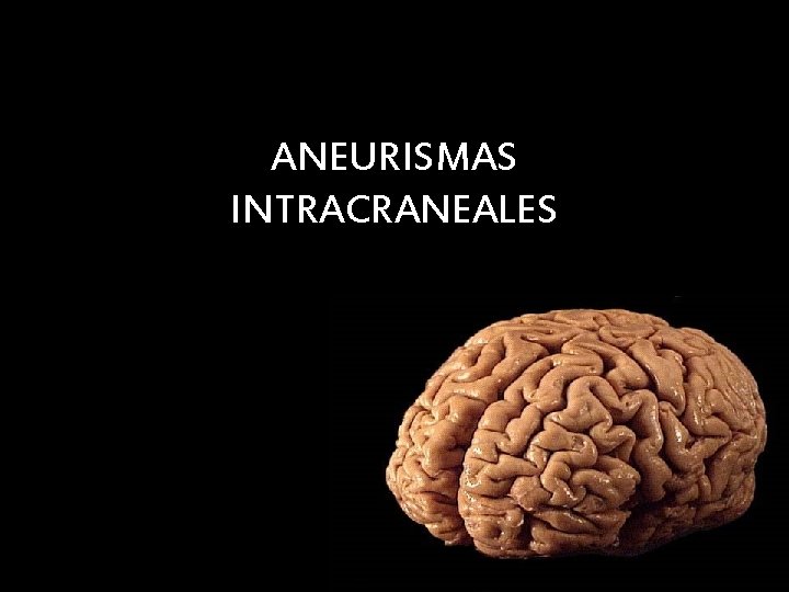 ANEURISMAS INTRACRANEALES ANEURISMAS INTRACRANEALES