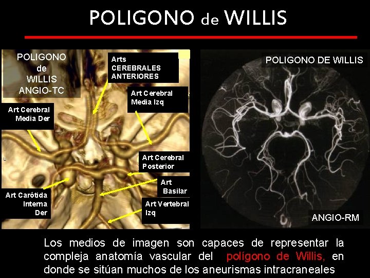 POLIGONO de WILLIS ANGIO-TC Art Cerebral Media Der Arts CEREBRALES ANTERIORES POLIGONO DE WILLIS POLIGONO de WILLIS ANGIO-TC Art Cerebral Media Der Arts CEREBRALES ANTERIORES POLIGONO DE WILLIS