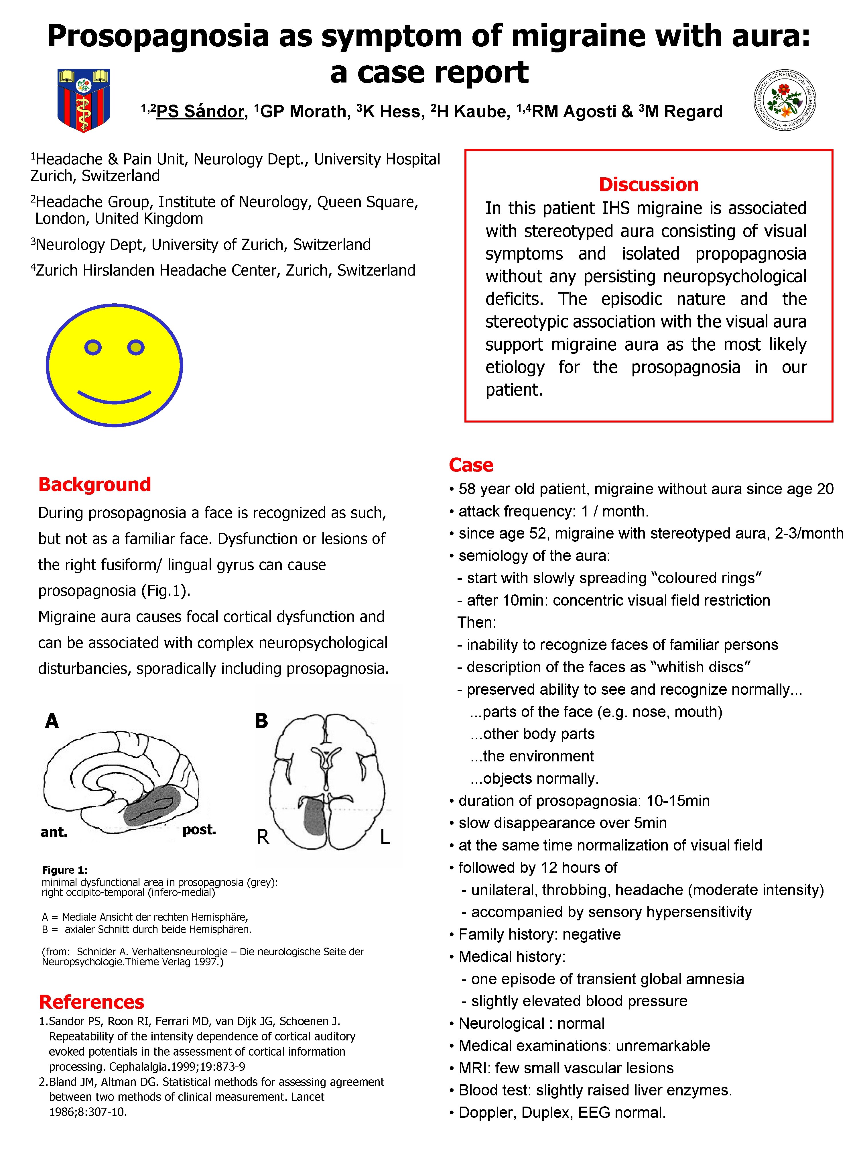 Prosopagnosia as symptom of migraine with aura: a case report 1, 2 PS Sándor, Prosopagnosia as symptom of migraine with aura: a case report 1, 2 PS Sándor,