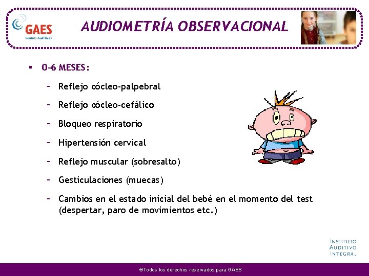 AUDIOMETRÍA OBSERVACIONAL § 0 -6 MESES: – Reflejo cócleo-palpebral – Reflejo cócleo-cefálico – Bloqueo AUDIOMETRÍA OBSERVACIONAL § 0 -6 MESES: – Reflejo cócleo-palpebral – Reflejo cócleo-cefálico – Bloqueo