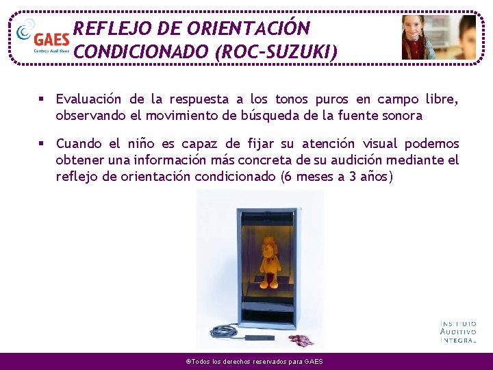 REFLEJO DE ORIENTACIÓN CONDICIONADO (ROC-SUZUKI) § Evaluación de la respuesta a los tonos puros REFLEJO DE ORIENTACIÓN CONDICIONADO (ROC-SUZUKI) § Evaluación de la respuesta a los tonos puros