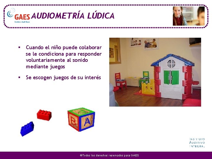 AUDIOMETRÍA LÚDICA § Cuando el niño puede colaborar se le condiciona para responder voluntariamente