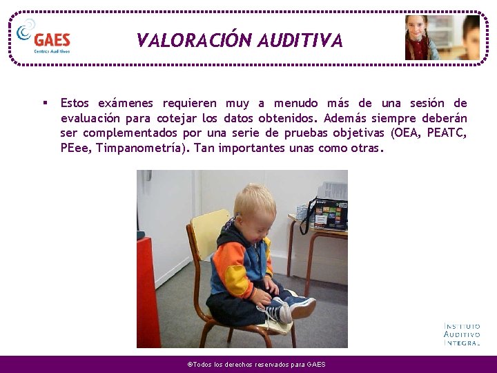 VALORACIÓN AUDITIVA § Estos exámenes requieren muy a menudo más de una sesión de