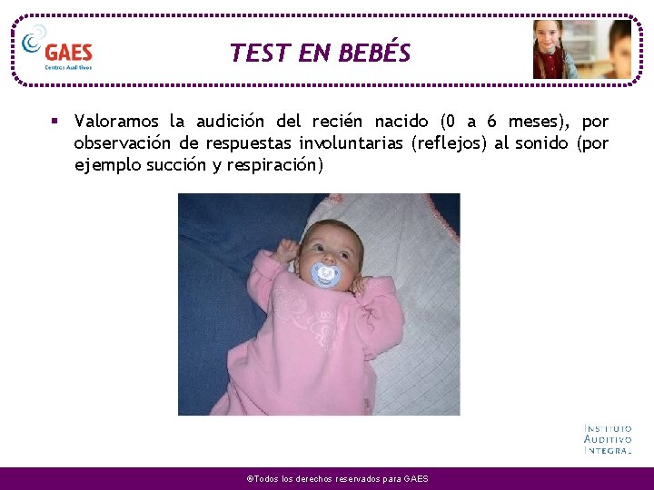 TEST EN BEBÉS § Valoramos la audición del recién nacido (0 a 6 meses),