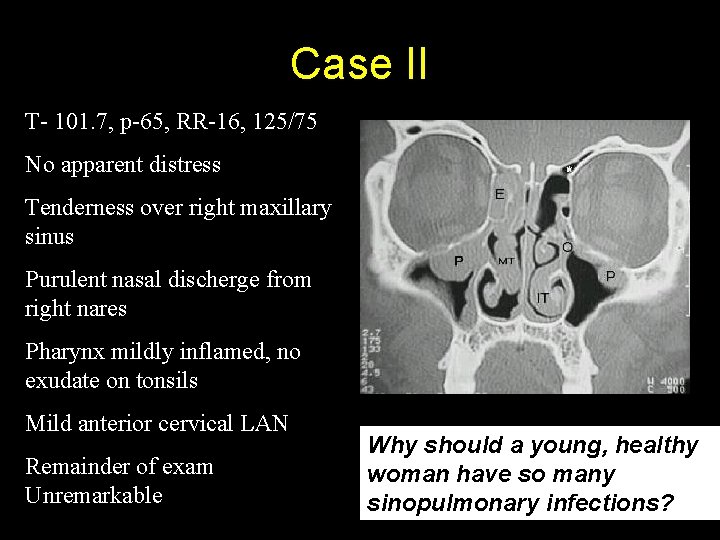 Case II T- 101. 7, p-65, RR-16, 125/75 No apparent distress Tenderness over right