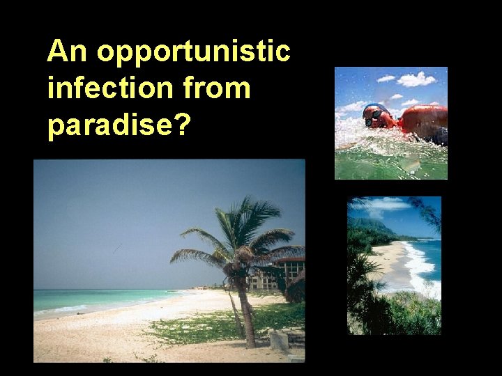 An opportunistic infection from paradise? 