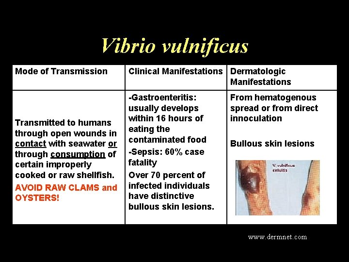 Vibrio vulnificus Mode of Transmission Transmitted to humans through open wounds in contact with