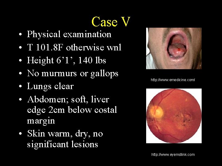  • • • Case V Physical examination T 101. 8 F otherwise wnl