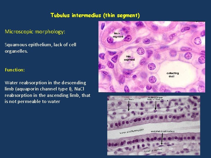 Tubulus intermedius (thin segment) Microscopic morphology: Squamous epithelium, lack of cell organelles. Function: Water