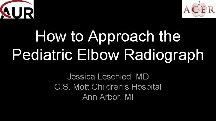 How to Approach the Pediatric Elbow Radiograph Jessica Leschied, MD C. S. Mott Children’s
