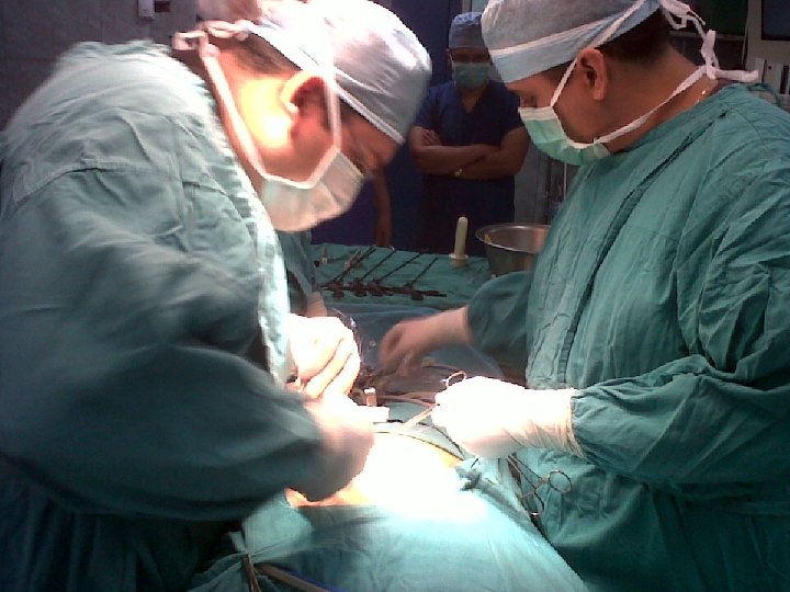 Instilación CO 2 l l Medición presión abdominal en insuflador– cercana a cero. Si