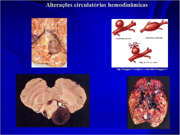 Alterações circulatórias hemodinâmicas http: //waggner 7. wordpress. com/author/waggner 7/ 