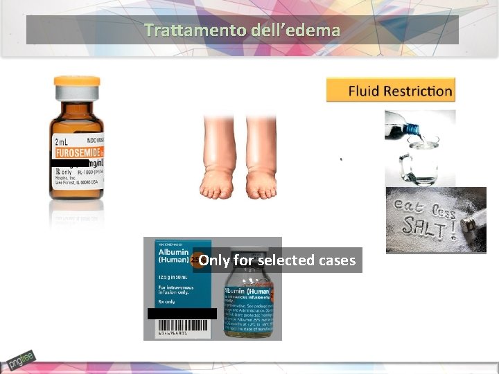 Trattamento dell’edema Only for selected cases 