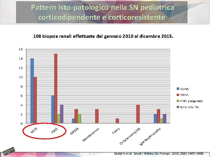 Pattern isto-patologico nella SN pediatrica corticodipendente e corticoresistente 108 biopsie renali effettuate dal gennaio