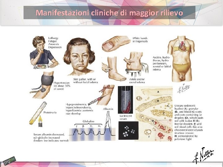 Manifestazioni cliniche di maggior rilievo 