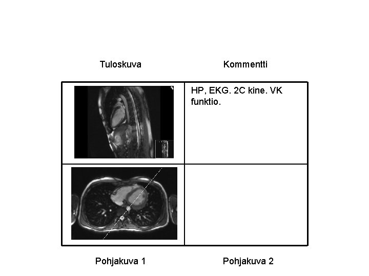 Tuloskuva Kommentti HP, EKG. 2 C kine. VK funktio. Pohjakuva 1 Pohjakuva 2 Tuloskuva Kommentti HP, EKG. 2 C kine. VK funktio. Pohjakuva 1 Pohjakuva 2