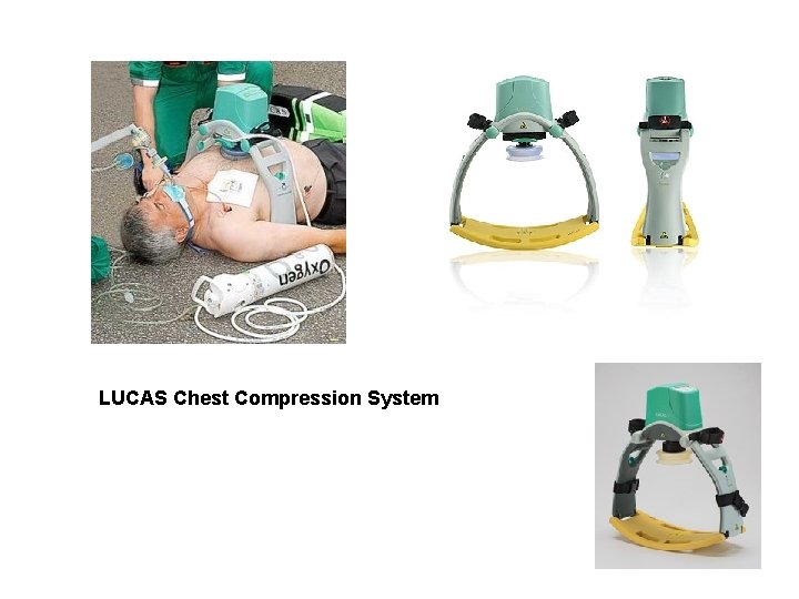 LUCAS Chest Compression System LUCAS Chest Compression System