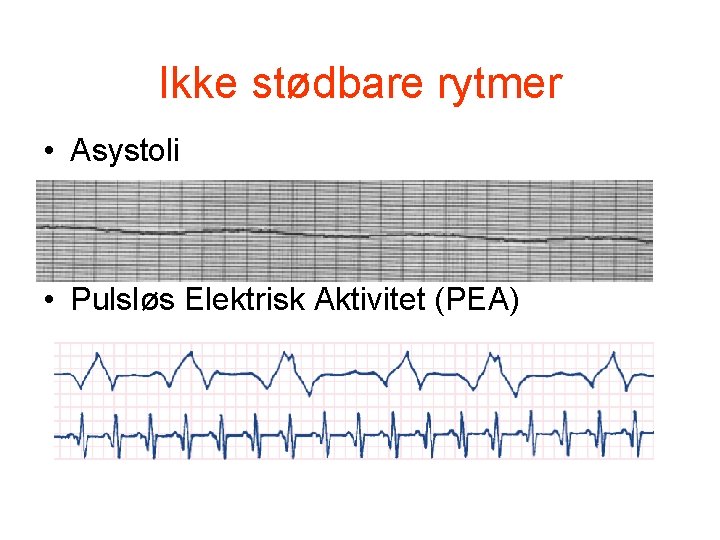 Ikke stødbare rytmer • Asystoli • Pulsløs Elektrisk Aktivitet (PEA) Ikke stødbare rytmer • Asystoli • Pulsløs Elektrisk Aktivitet (PEA)
