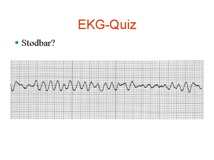 EKG-Quiz § Stødbar? EKG-Quiz § Stødbar?