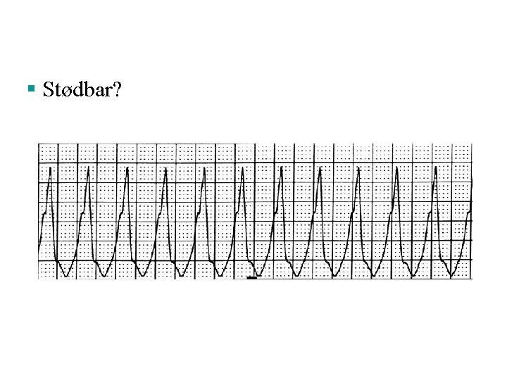 § Stødbar? § Stødbar?