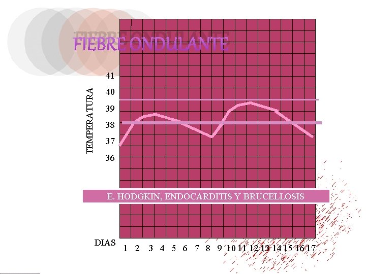 FIEBRE ONDULANTE TEMPERATURA 41 40 39 38 37 36 E. HODGKIN, ENDOCARDITIS Y BRUCELLOSIS