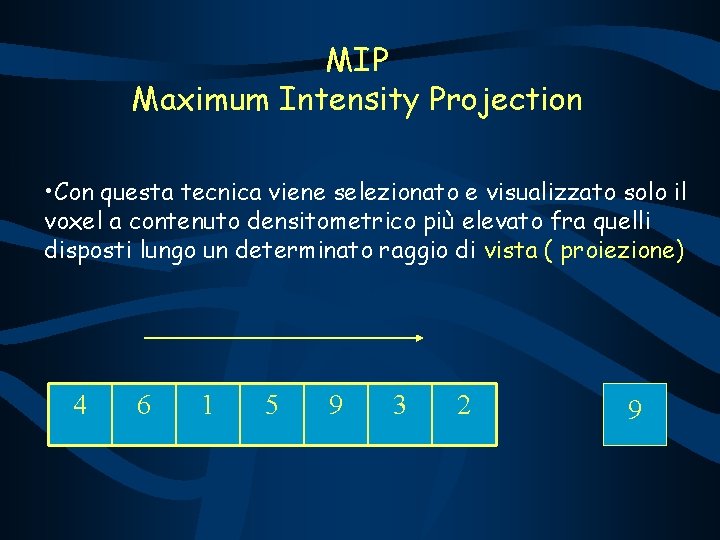 MIP Maximum Intensity Projection • Con questa tecnica viene selezionato e visualizzato solo il