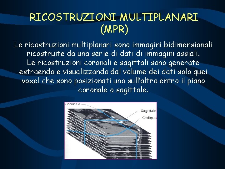 RICOSTRUZIONI MULTIPLANARI (MPR) Le ricostruzioni multiplanari sono immagini bidimensionali ricostruite da una serie di