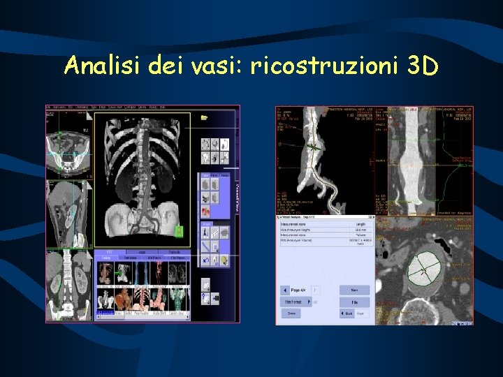 Analisi dei vasi: ricostruzioni 3 D 