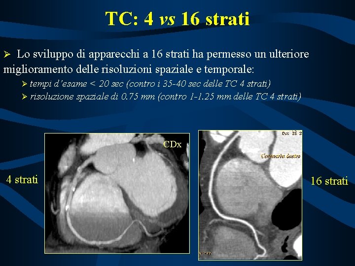 TC: 4 vs 16 strati Lo sviluppo di apparecchi a 16 strati ha permesso