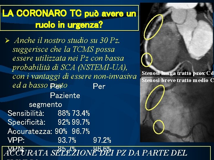 LA CORONARO TC può avere un ruolo in urgenza? Anche il nostro studio su