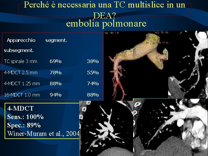 Perché è necessaria una TC multislice in un DEA? embolia polmonare Apparecchio segment. subsegment.