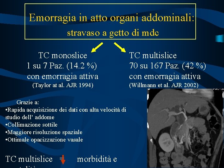 Emorragia in atto organi addominali: stravaso a getto di mdc TC monoslice 1 su