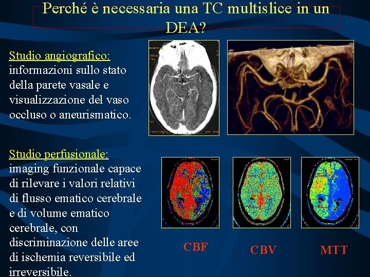 Perché è necessaria una TC multislice in un DEA? Studio angiografico: informazioni sullo stato