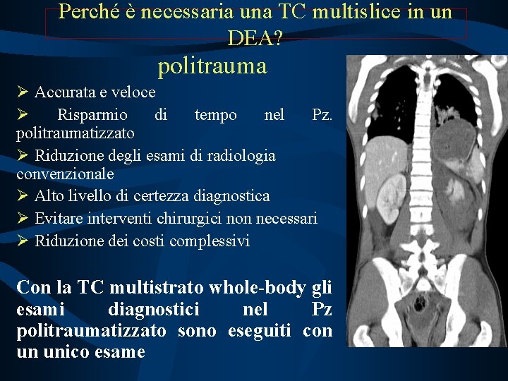 Perché è necessaria una TC multislice in un DEA? politrauma Accurata e veloce Risparmio