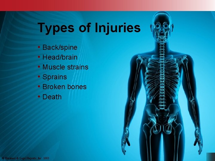 Types of Injuries • Back/spine • Head/brain • Muscle strains • Sprains • Broken